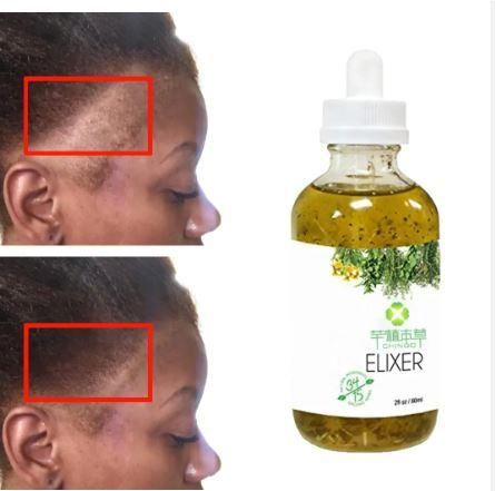 Scalp Elixirs Hair Care Loss Treatment Hair Growth Oil Serum (60 ML)