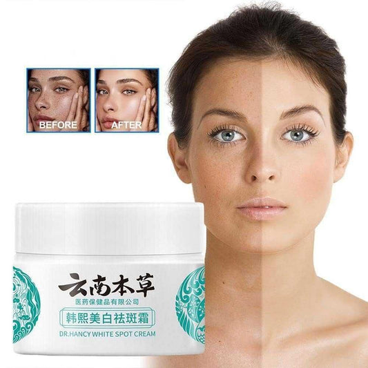 Japanese Melasma Cream (Pack of 2)