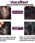 Foam Shampoo for Hair Growth & Hair Loss 60ml